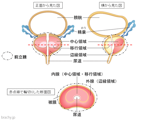 前立腺構造は、移行領域、中心領域、周辺領域という3つの領域がある